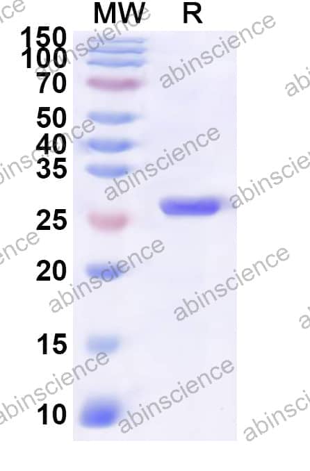 Human KANK1 Recombinant Protein (N-His)