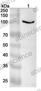 Anti-KANK1 Polyclonal Antibody