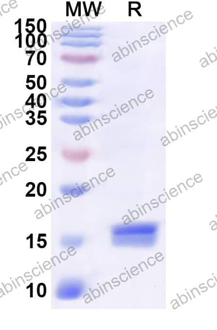 Human RGS1 Recombinant Protein (N-His)