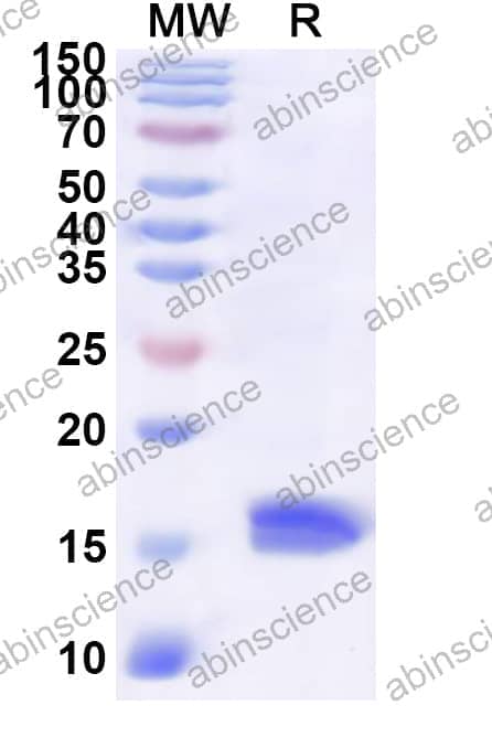 Human PEA15 Recombinant Protein (N-His)