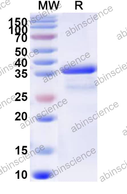 Human CARD18 Recombinant Protein (N-GST & C-His)