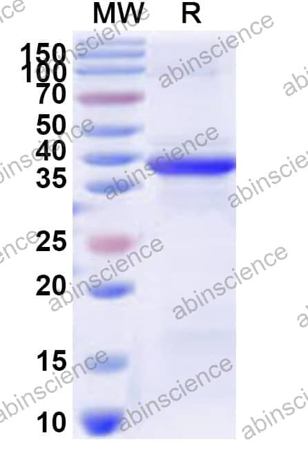 Human RPS29 Recombinant Protein (N-GST & C-His)