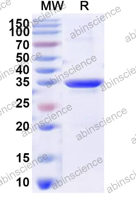 Human RPL30 Recombinant Protein (N-His)