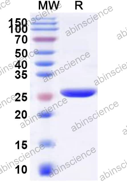 Human NMRK1 Recombinant Protein (N-His)