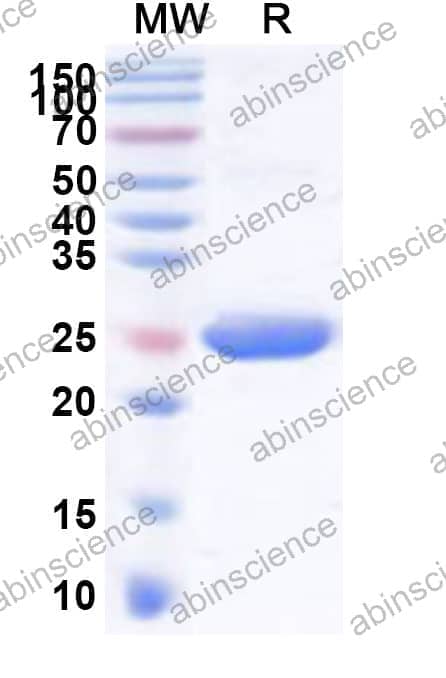 Human UBE2R2 Recombinant Protein (N-His)
