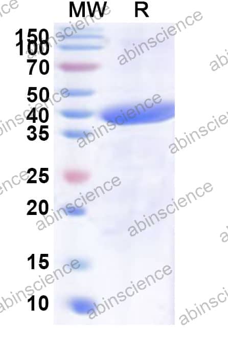 Human SLC4A10 Recombinant Protein (N-His)