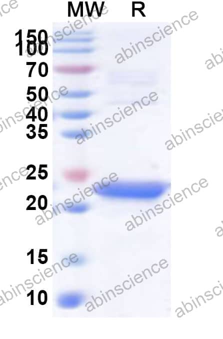 Human CDC73 Recombinant Protein (N-His)