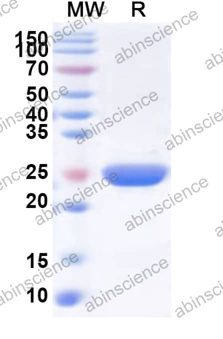 Human SMU1 Recombinant Protein (N-His)