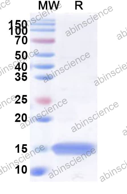 Human CNN3 Recombinant Protein (N-His)