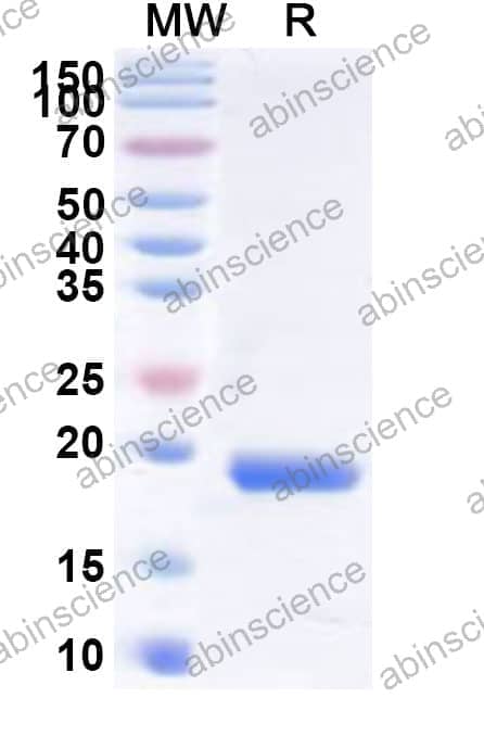 Human TRIP4 Recombinant Protein (N-His)