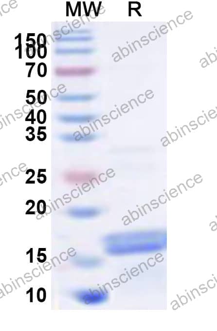 Human FIP1L1 Recombinant Protein (N-His)