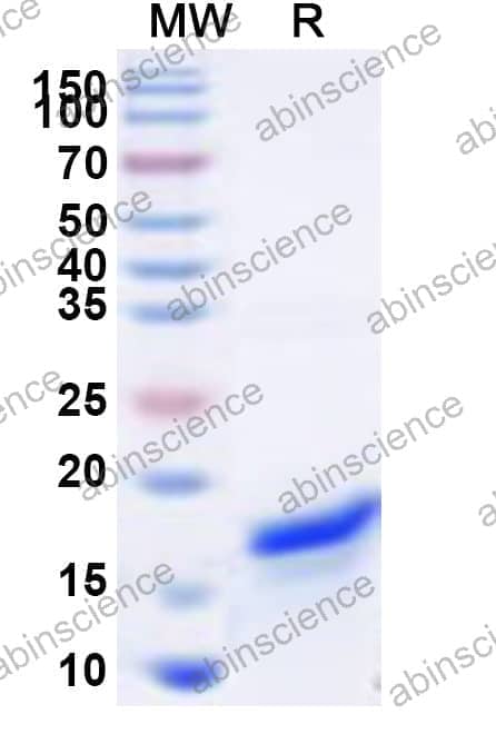 Human SLC30A9 Recombinant Protein (N-His)