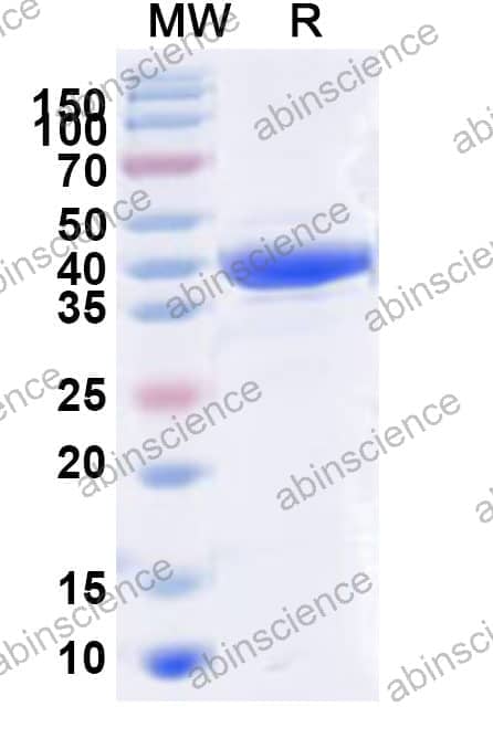 Human ADPRS Recombinant Protein (N-His)