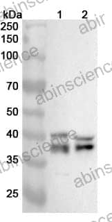 Anti-ADPRS Polyclonal Antibody