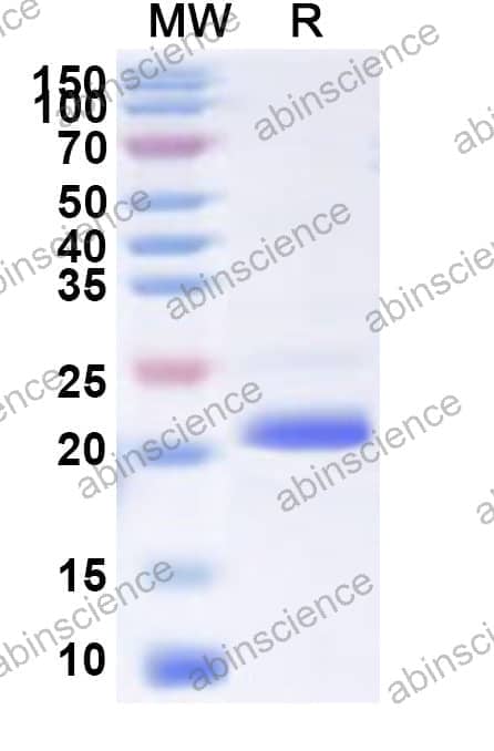 Human POLE3 Recombinant Protein (N-His)