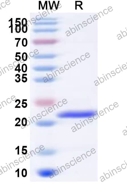 Human GTF2H2 Recombinant Protein (N-His)