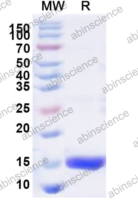 Human SF3A1 Recombinant Protein (N-His)