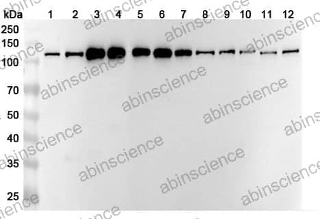 Anti-SF3A1 Polyclonal Antibody
