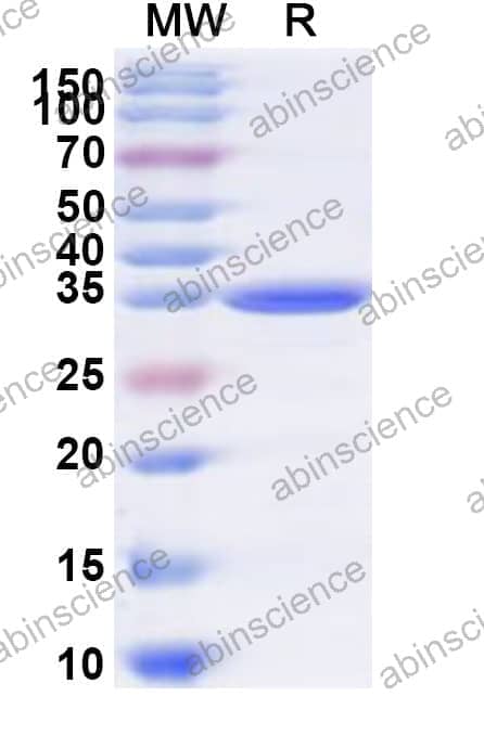 Human BEND3 Recombinant Protein (N-His)