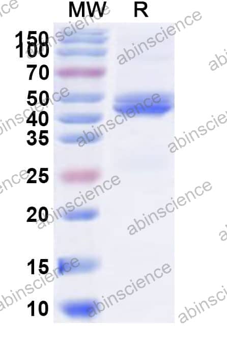 Human DMPK Recombinant Protein (N-His)