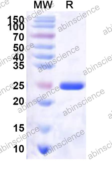 Human CDK2AP2 Recombinant Protein (N-His-KSI)