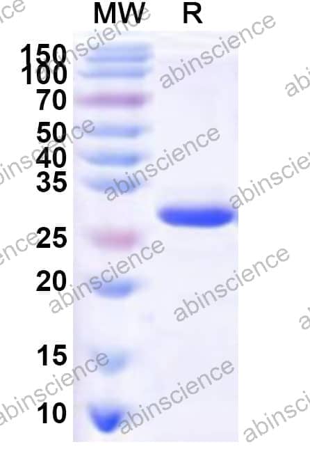 Human SNAPC5 Recombinant Protein (N-His-KSI)