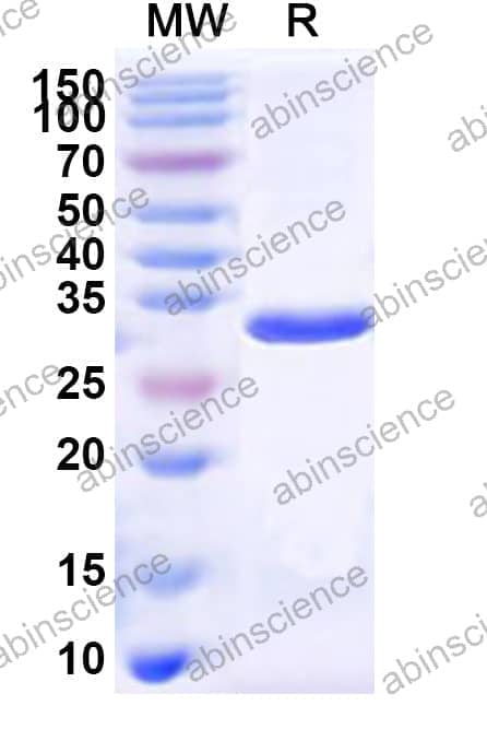 Human H2AP Recombinant Protein (N-His-KSI)