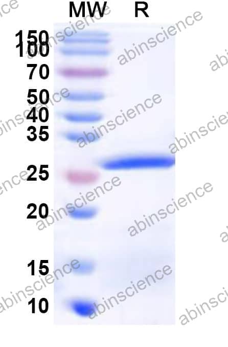 Human QSOX2 Recombinant Protein (N-His)
