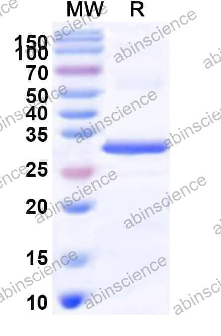 Human INSRR Recombinant Protein (N-His)