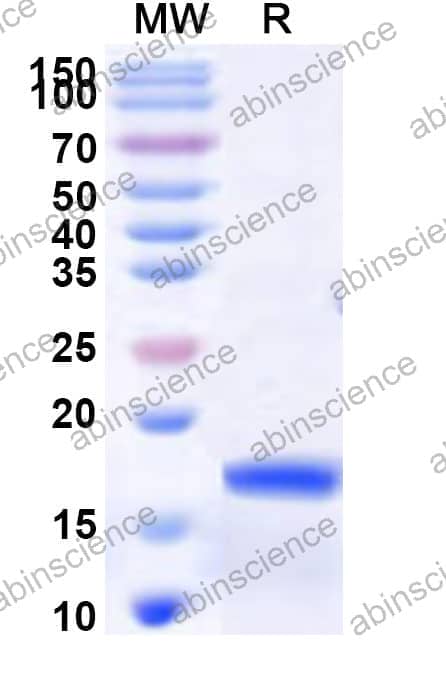 Human PHLPP2 Recombinant Protein (N-His)