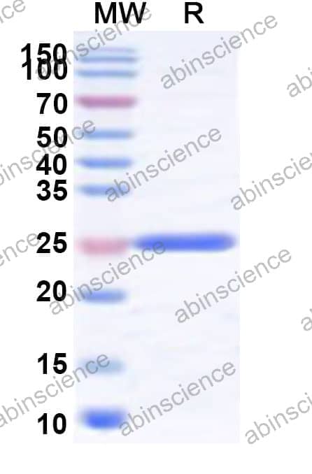 Human SRSF5 Recombinant Protein (N-His)