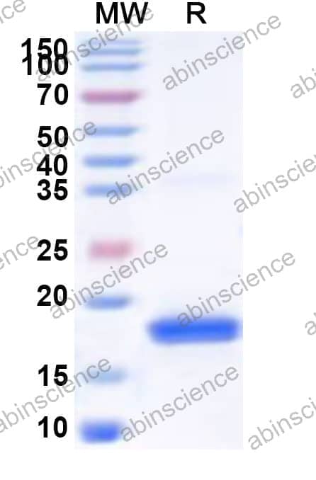 Human TAF11 Recombinant Protein (N-His)
