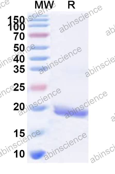 Human RPL36A Recombinant Protein (N-His)