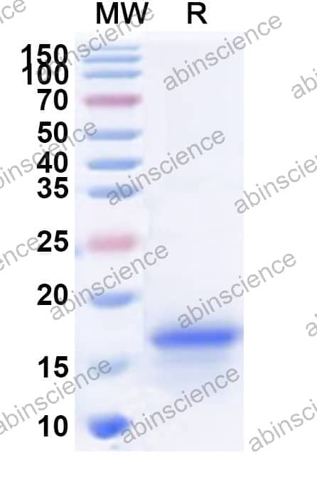 Human SNRPD3 Recombinant Protein (N-His)