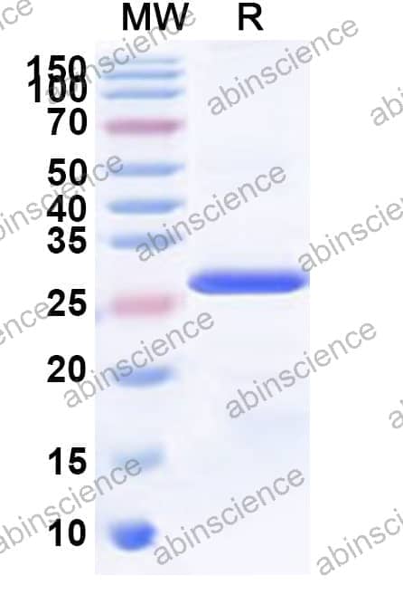 Human MPP7 Recombinant Protein (N-His)