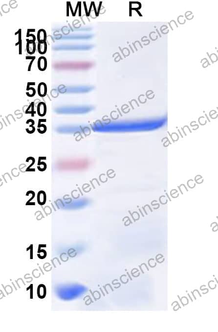 Human ASCL4 Recombinant Protein (N-GST & C-His)