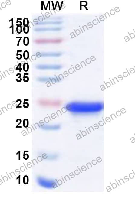 Human TAF7 Recombinant Protein (N-His)