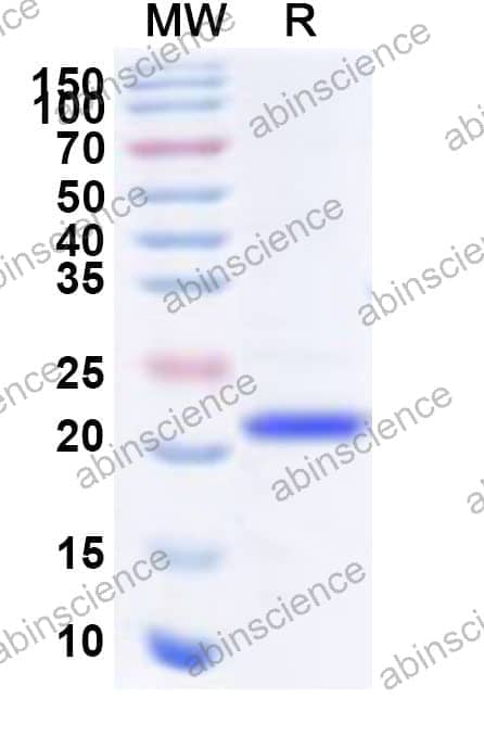 Human PHLDA2 Recombinant Protein (N-His)