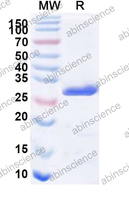 Human PSME1 Recombinant Protein (N-His)
