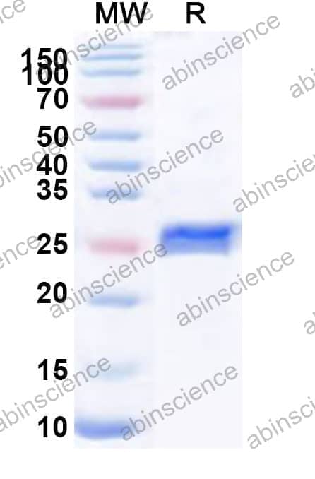 Human NSMF Recombinant Protein (N-His)