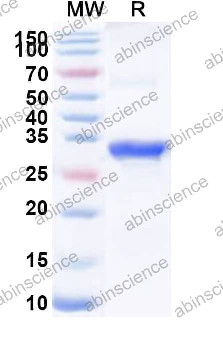 Human SLC13A2 Recombinant Protein (N-His-KSI)