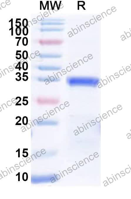 Human PAX3 Recombinant Protein (N-His)