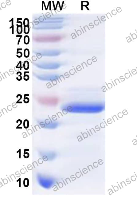 Human SLC39A5 Recombinant Protein (N-His)