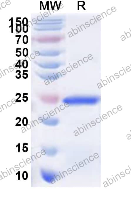 Human BNC2 Recombinant Protein (N-His)