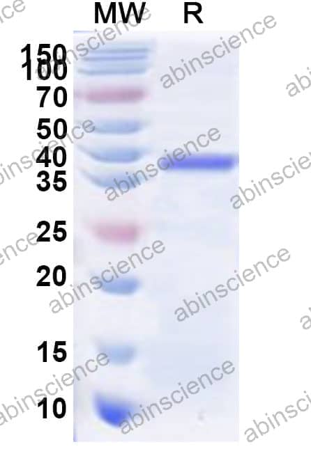Human ZNF322 Recombinant Protein (N-His)