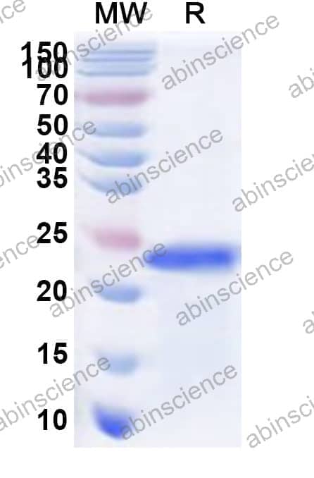 Human RNF19B Recombinant Protein (N-His)
