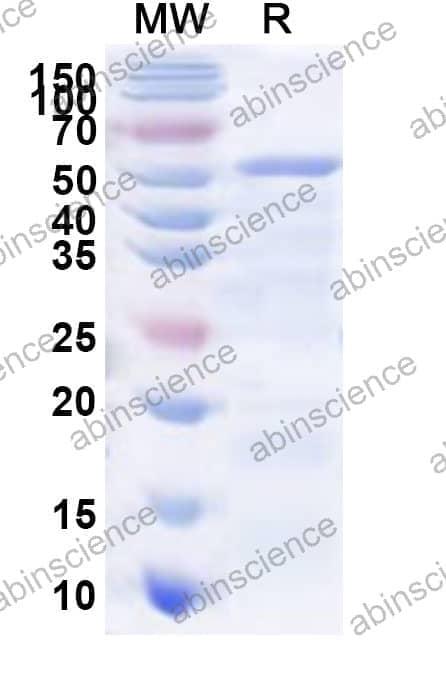 Human GALNT18 Recombinant Protein (N-His)