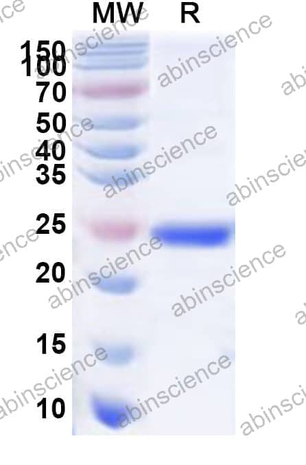 Human APOBEC3H Recombinant Protein (N-His)