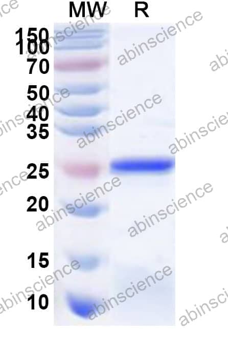 Human IYD Recombinant Protein (N-His)