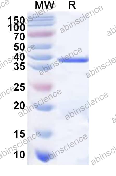 Human DMGDH Recombinant Protein (N-His)